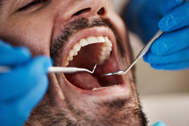 Best Chipped Tooth Repair Near Me  in Pittsville, MD