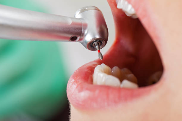 Best Cracked Tooth Emergency Dentist  in Pittsville, MD